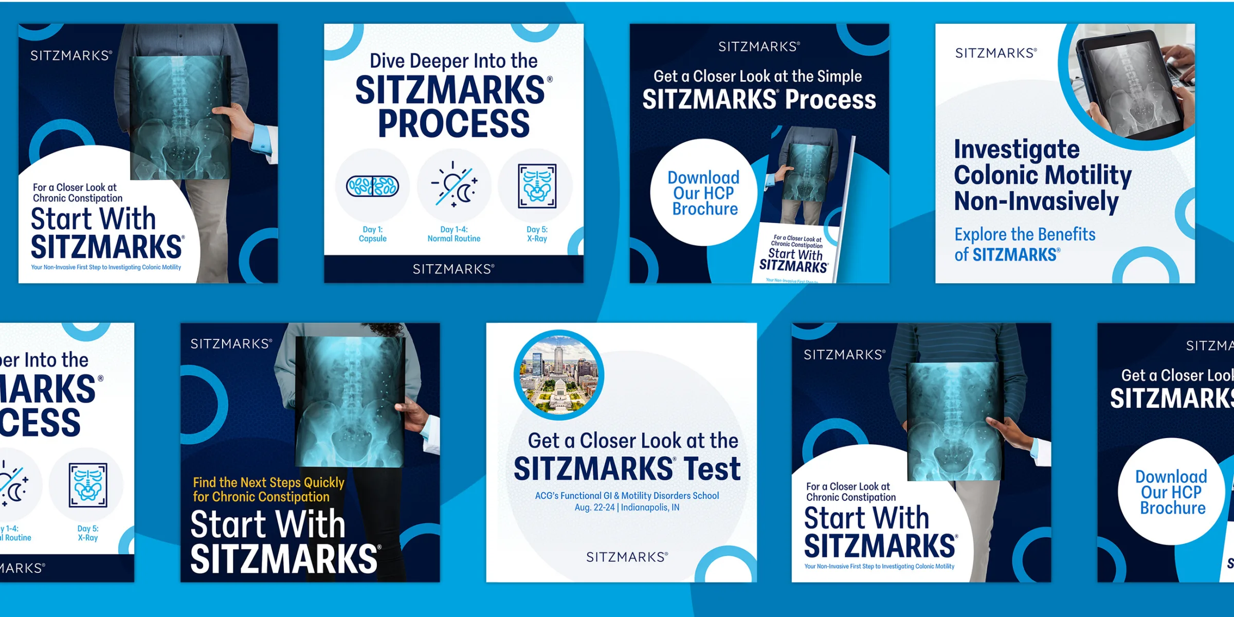 Collection of social media graphics promoting SITZMARKS process benefits and calls to action for learning more about colonic motility testing