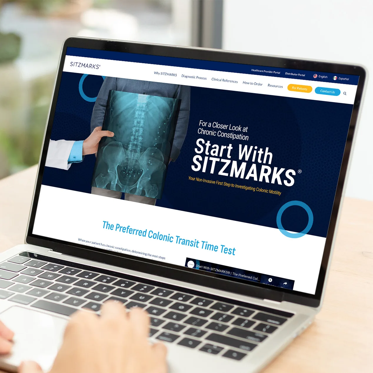 Laptop screen displaying SITZMARKS website homepage with headline Start With SITZMARKS and navigation for diagnostic resources