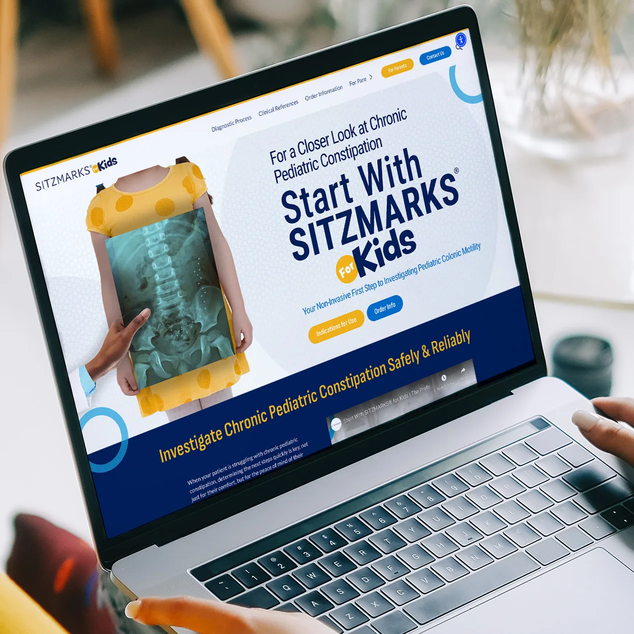 Laptop screen showing SITZMARKS for kids webpage with messaging about investigating pediatric colonic motility and options for ordering and information
